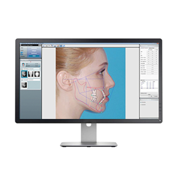 OrthoVision